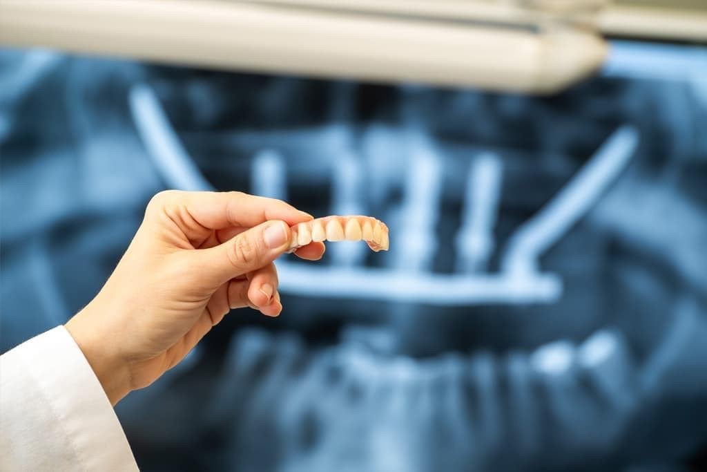 El futuro de los implantes dentales en nuestra clínica dental en Vigo