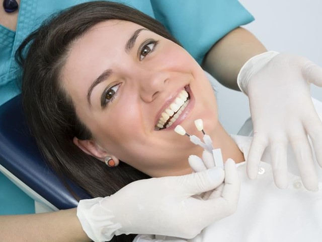 Transforma tu sonrisa sin cirugía con las carillas dentales